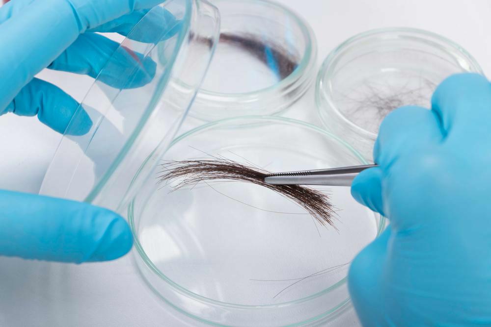 Wat kost een haaranalyse in België | Intolaw advocaten